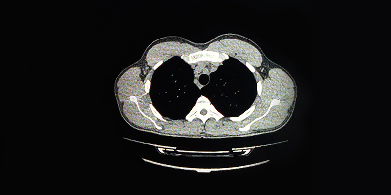 Investigations CT Scan