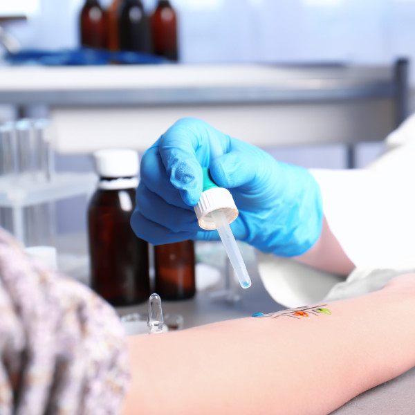 Doctor making allergy test in laboratory