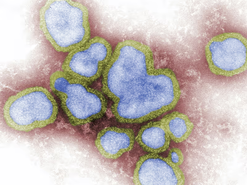 Influenza virus microscopic view